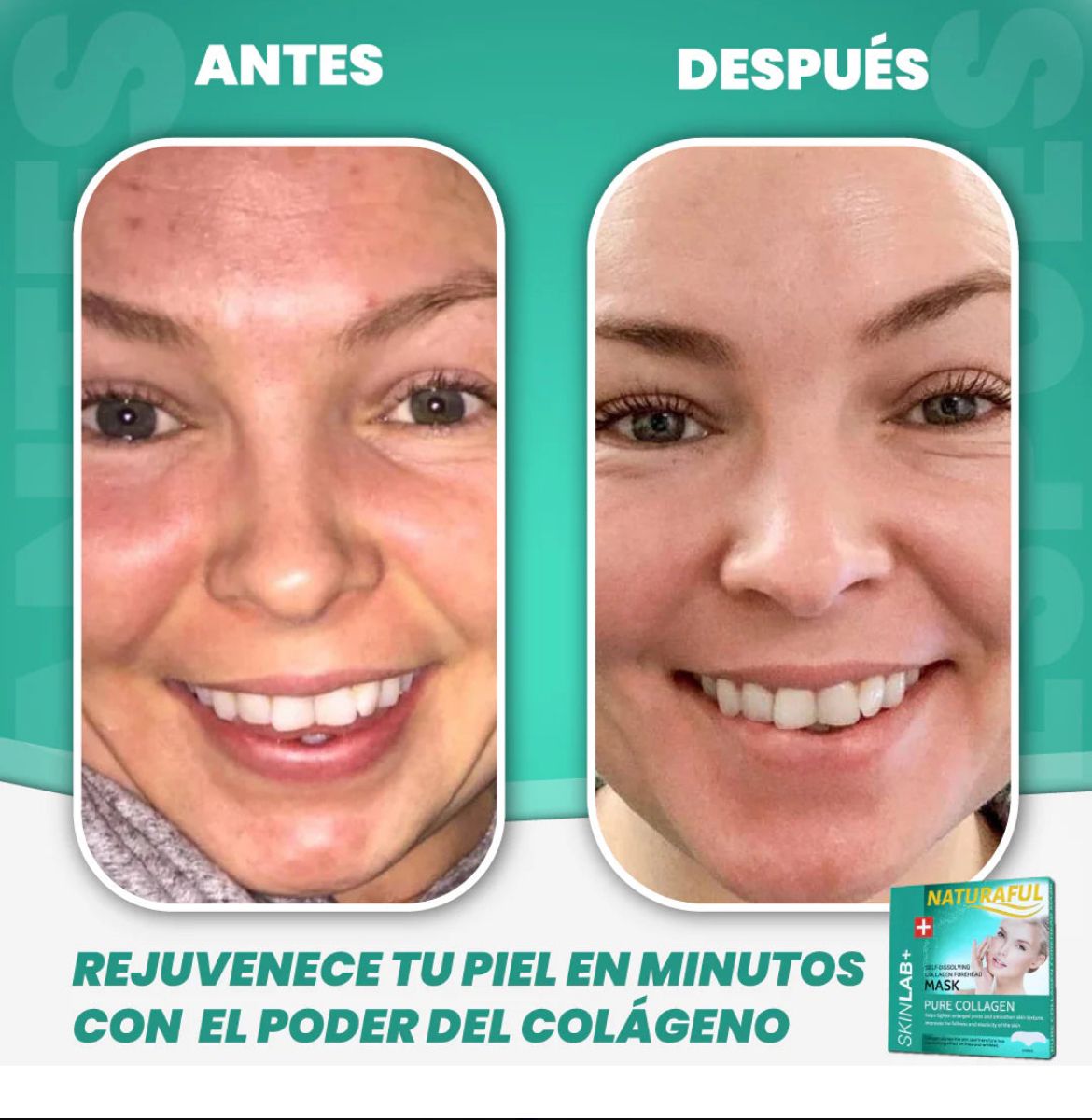 MagicCollagen® | Elimina las arrugas en solo semanas